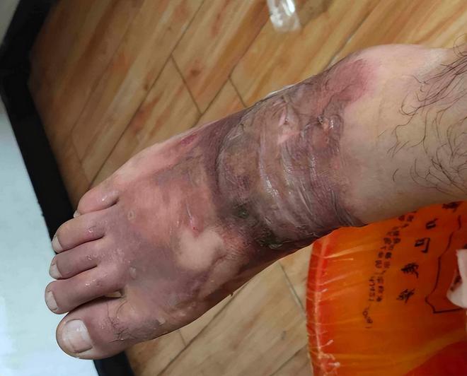 必威冷水壶烫伤老人家属索赔10000元厂家：我让你往里放烫水的(图6)